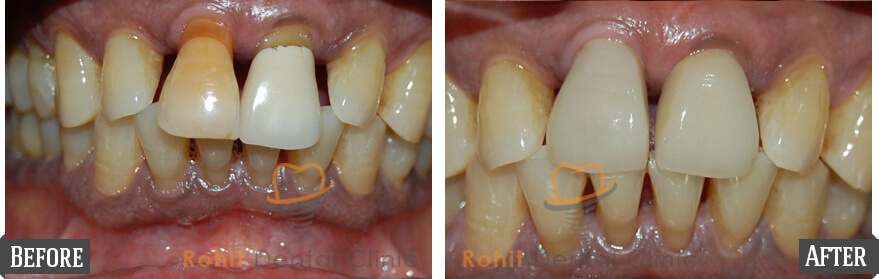 results-gallery-19 (1)