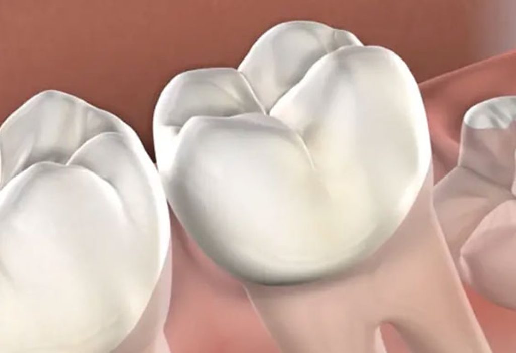 Best-Wisdom-Tooth-Extraction-Clinic-in-Ludhiana