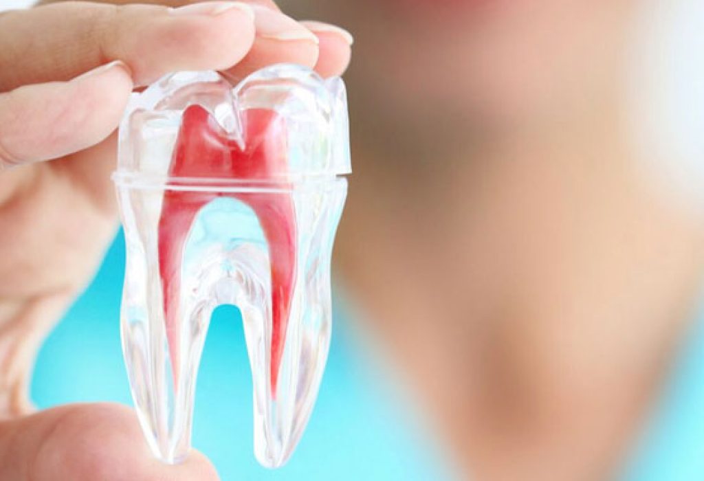 Root-Canal-Treatment
