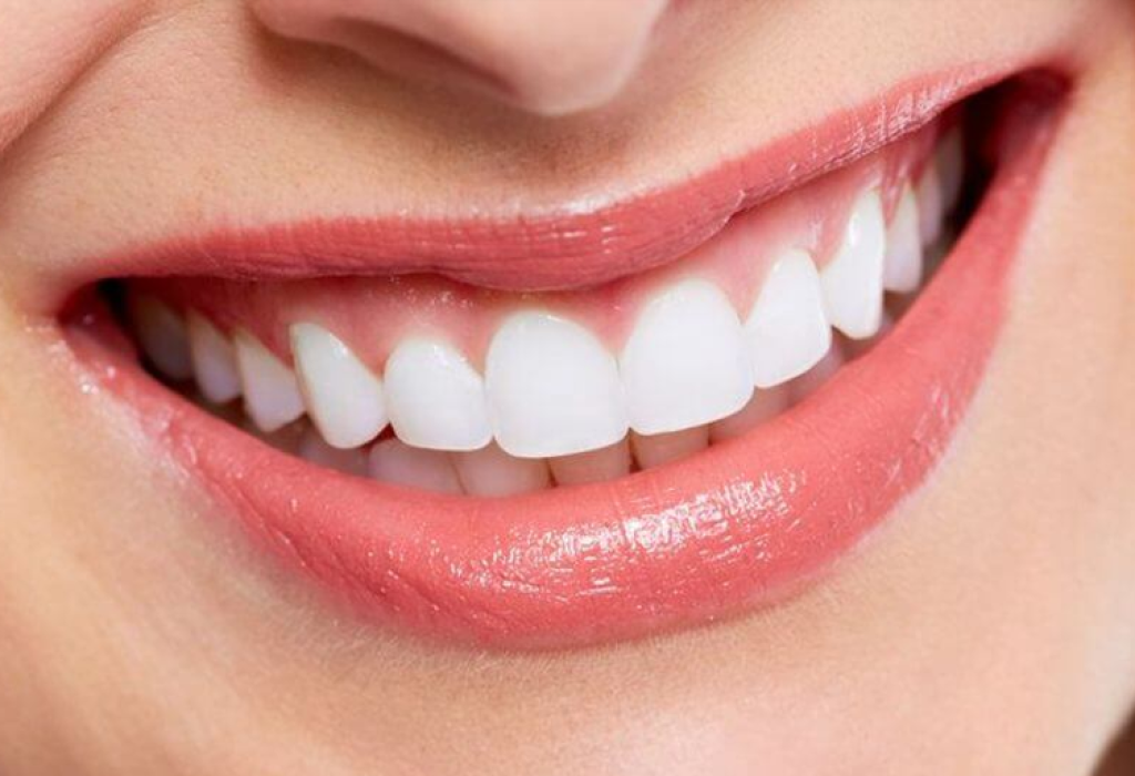 Smile-Designing