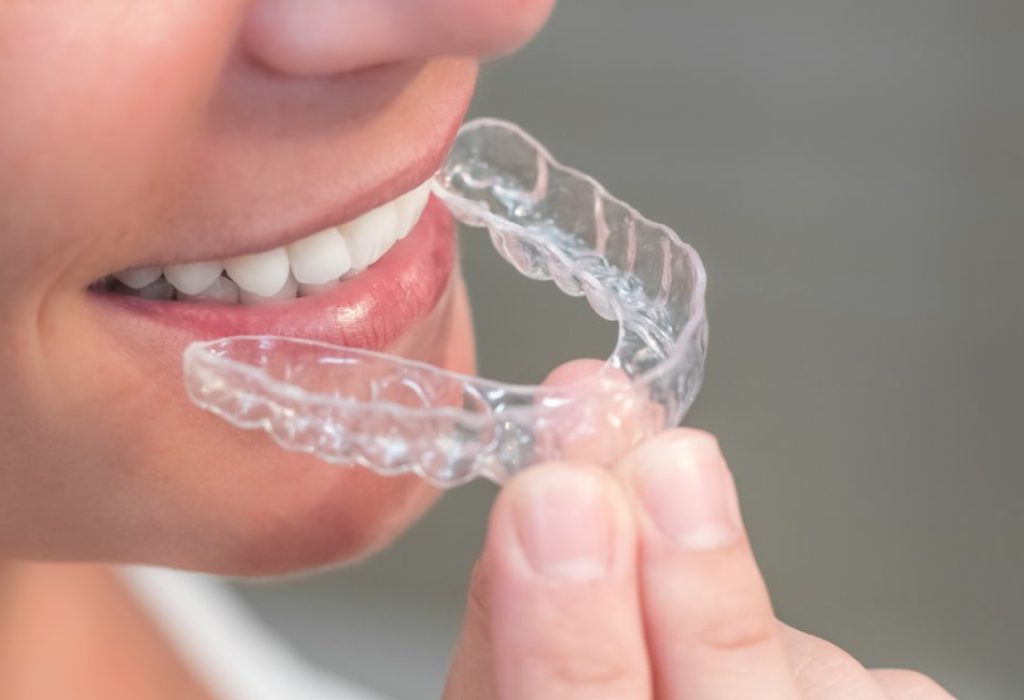 invisalign-treatment