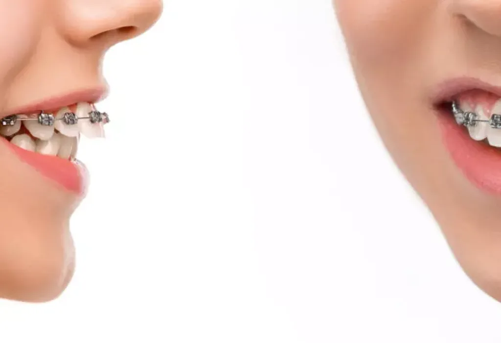 shutterstock_602486195-1-scaled-1400x500